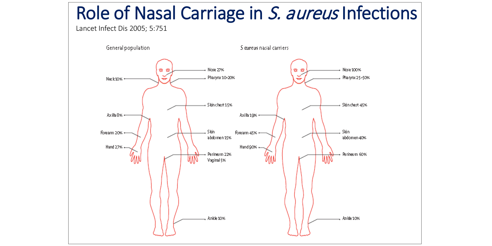 Decolonization to Prevent Infection CE Webinar